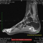 Röntgenbild vom Profil eines Fußes